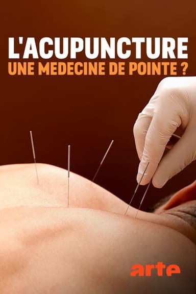 Spitzenmedizin: Akupunktur - Mythos oder Therapie? poster