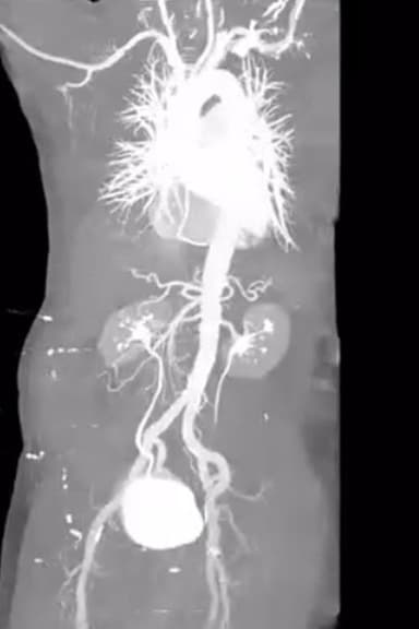 X-Ray Eros poster