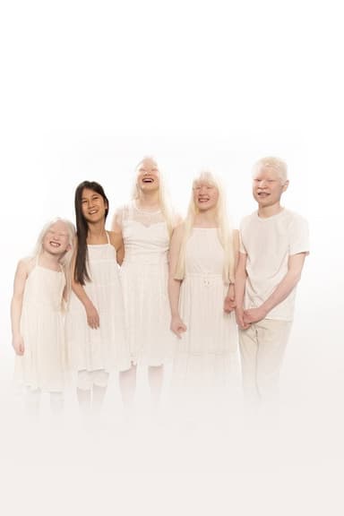 Born with Albinism poster