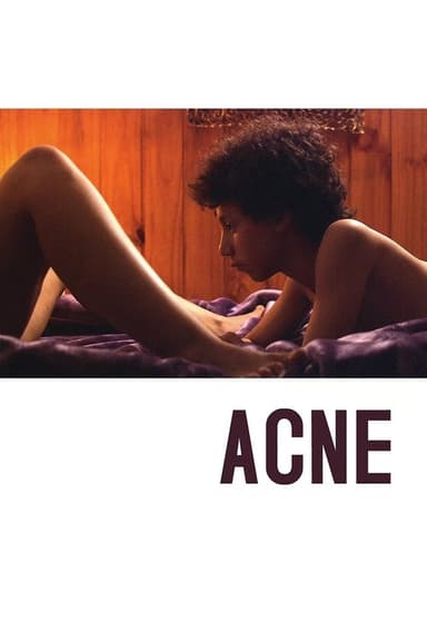 Acne poster