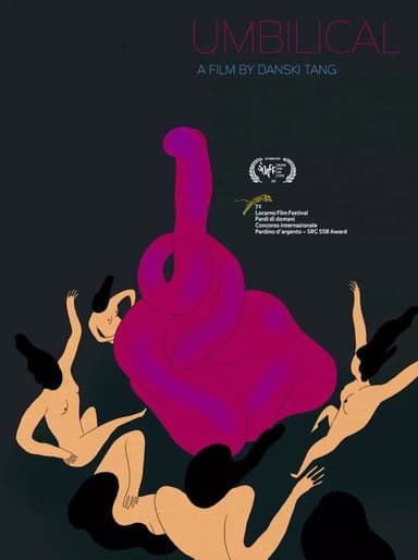 Umbilical poster