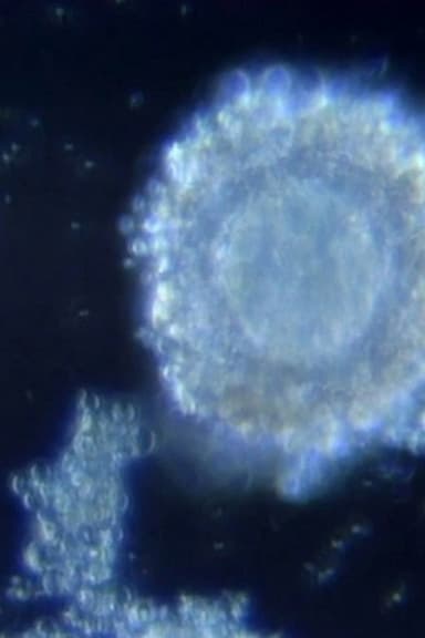 Fertilization in Video poster