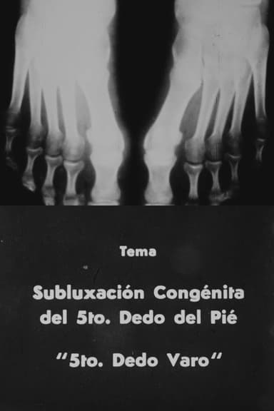 5to. dedo varo poster