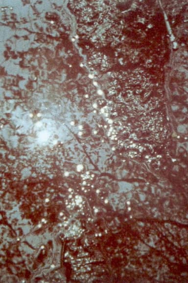 Lysis poster
