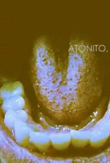 Atônito, Eu. poster