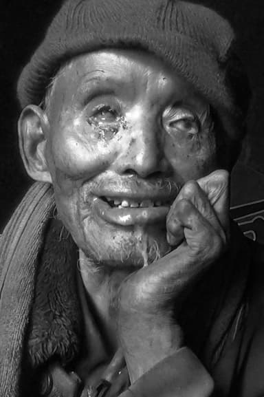 Blessing of Leprosy poster