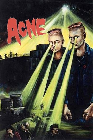 Acne poster