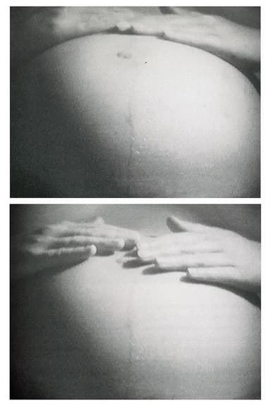 Antepartum poster