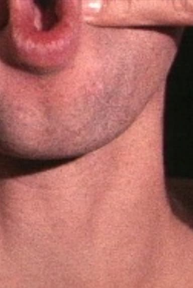 Pinchneck poster